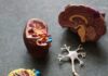 Traumatic Brain Injury